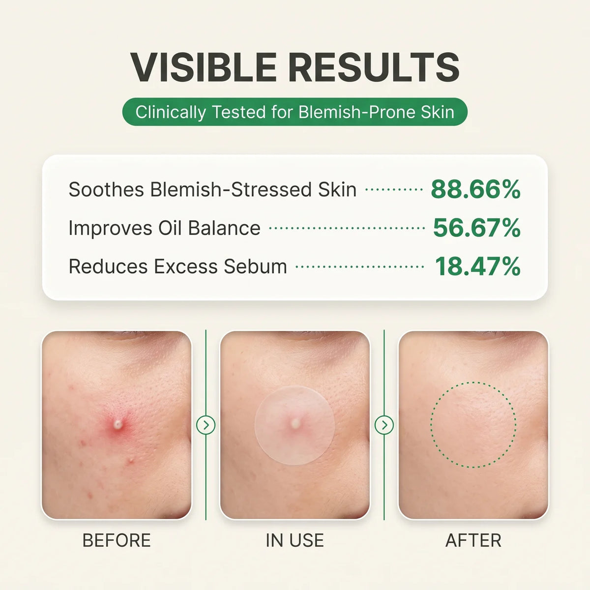 Elivya Invisible Pimple Patches