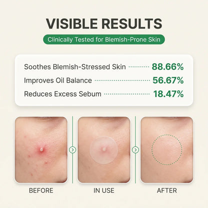 Elivya Invisible Pimple Patches